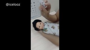массаж Криглера при непроходимости слезных путей