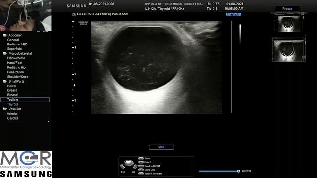 Live demonstration of various pathological conditions of the orbit using a ultrasound B scan. смотреть онлайн
