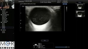 Live demonstration of various pathological conditions of the orbit using a ultrasound B scan.