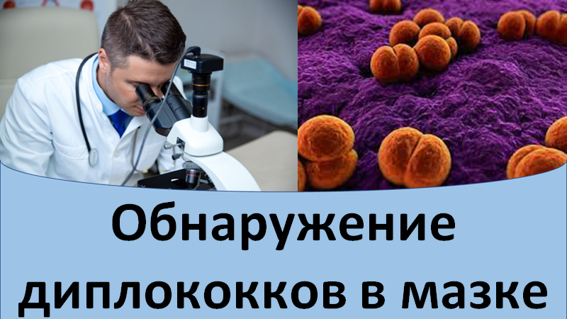 Обнаружение диплококков в мазке