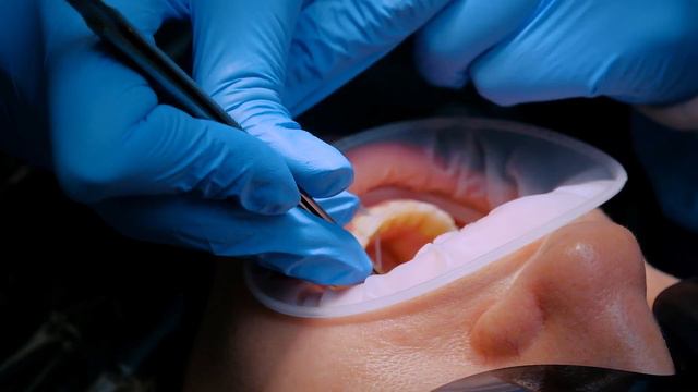 Гигиена полости рта. смотреть онлайн