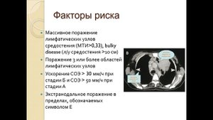 Лекция "Злокачественные лимфомы"
