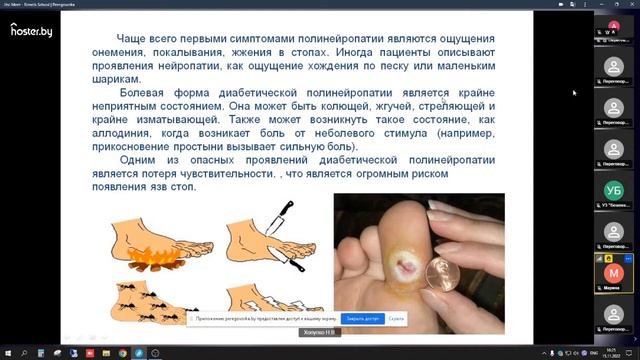 Основные хронические осложнения при сахарном диабете 1 типа, профилактика, ранняя диагностика
