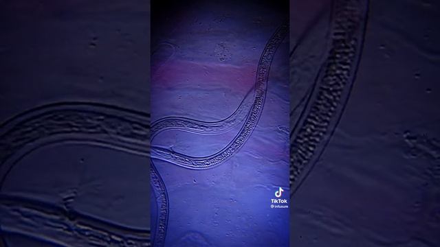 Инжир под микроскопом