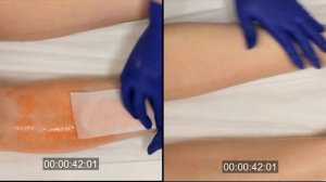 Italwax. Депиляция сахарной пастой и тёплым воском.