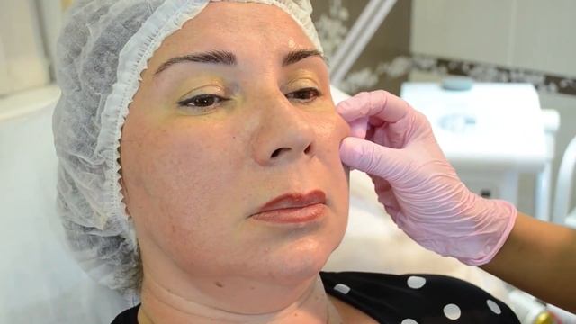 Типы старения лица и МЕТОДЫ омоложения | Мнение врача
