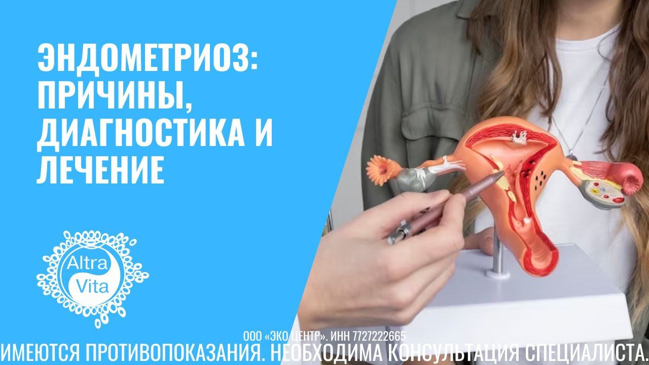 Эндометриоз: причины, диагностика и лечение