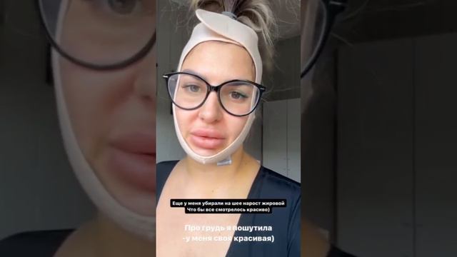 Восстановление Маюшечки после липомоделирования тела и липосакции подбородка 🤕