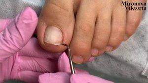 Педикюр/ Аппаратная обработка стопы с помощью гибридный фрез