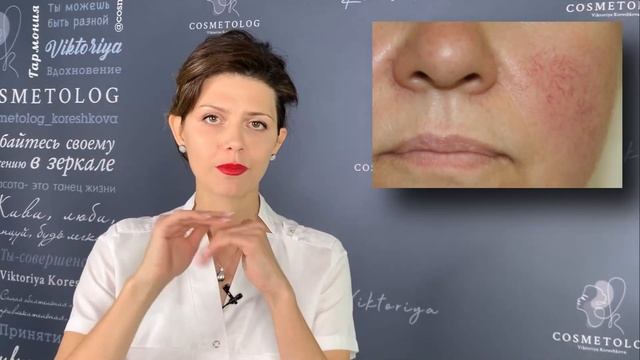 Как выбрать ПИЛИНГ ДЛЯ ЧУВСТВИТЕЛЬНОЙ КОЖИ? Пилинг при КУПЕРОЗЕ ? Косметолог отвечает на вопросы