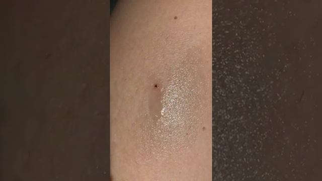 Как вытащить клеща на даче смотреть онлайн