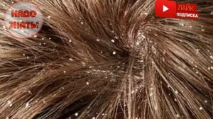 Почему появляется перхоть?