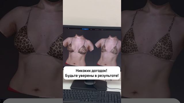 3D моделирование: визуализация будущего результата операции! #пластическаяхирургия