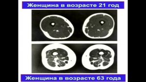 Нужно ли заниматься спортом чтобы жить долго?  (ТВ- 1Канал)