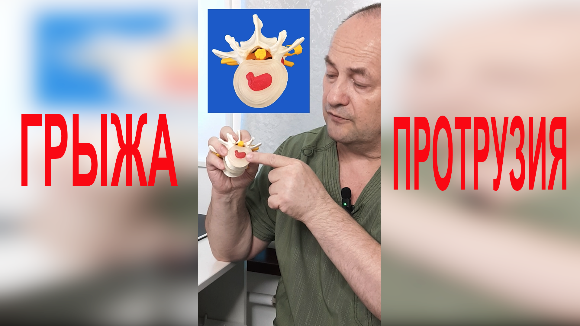 Грыжа позвоночника и протрузия. В чём разница?