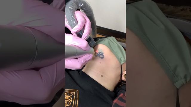 Closer look of neck tattoo removal.