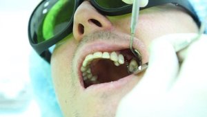 Лазерная имплантация