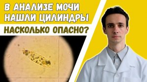 Цилиндры обнаружены в анализе мочи? Стоит ли бить тревогу? 2023