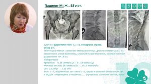 Дегенеративно дистрофические заболевания суставов Т Поткина @Артлайф Artlife Беларусь