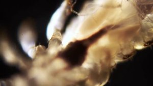 Вошь под микроскопом 100х HD качестве