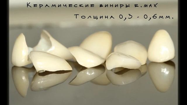 Виниры в Rock and Gloss