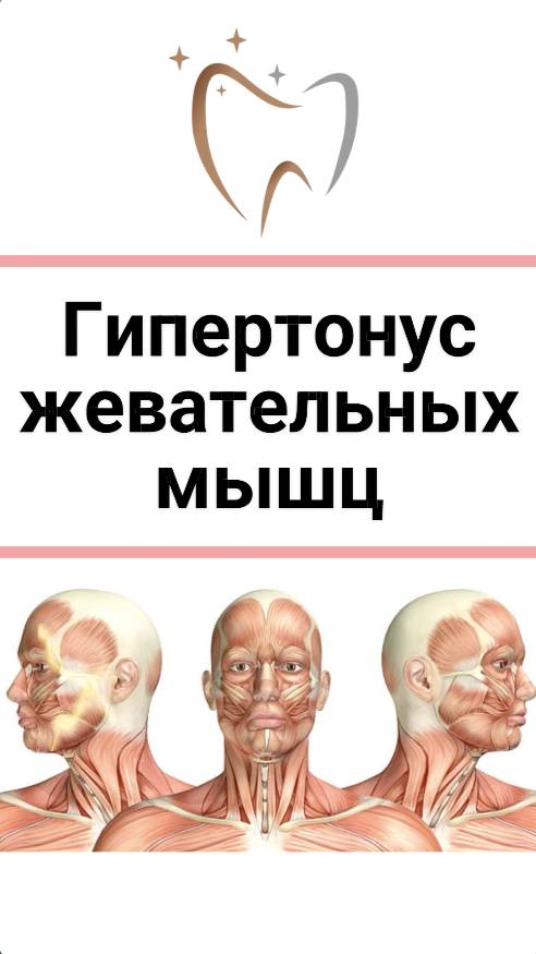 Гипертонус жевательных мышц