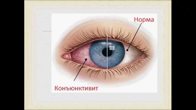 Гигиена зрения. Урок биологии.