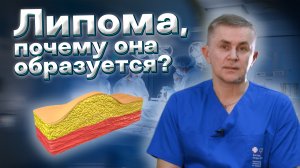 Что такое липома? Как она выглядит? Почему образуется?