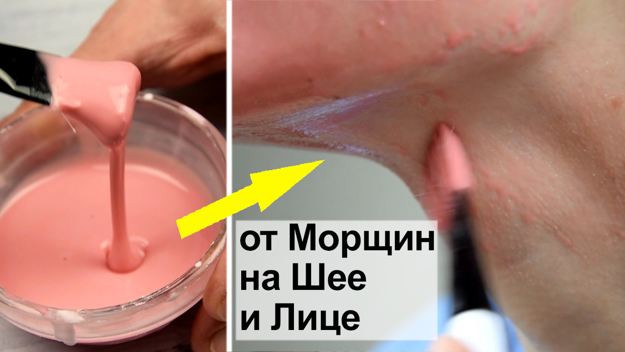 Разгладит даже глубокие морщины на лице, шее и декольте. Быстрый рецепт маски от морщин