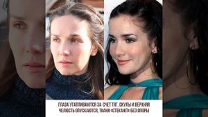 ЧТО ПРОИЗОШЛО С 47-ЛЕТНЕЙ НАТАЛИЕЙ ОРЕЙРО?