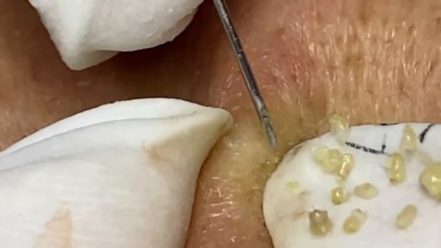 Enjoy Every Day With The Best Video Loan Nguyen Spa Official 2637 смотреть онлайн