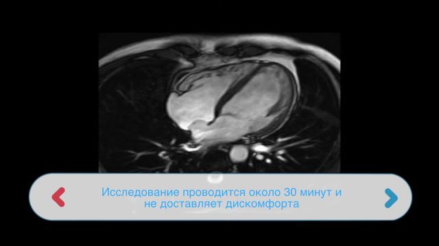 МРТ малого таза