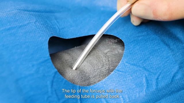 A guide to placement of an oesophagostomy tube in a cat - subtitles смотреть онлайн