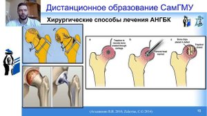 Наш подход к диагностике и оперативному лечению больных с АНГБК