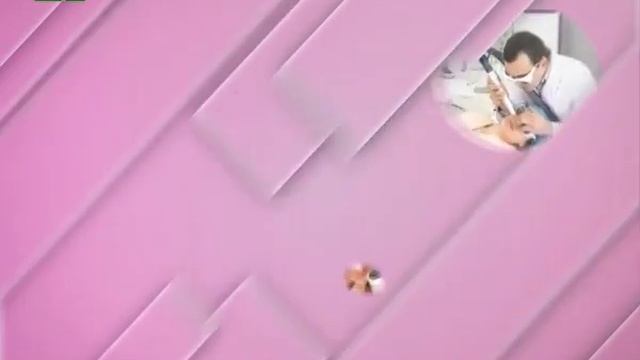 Схема красоты Родинки смотреть онлайн