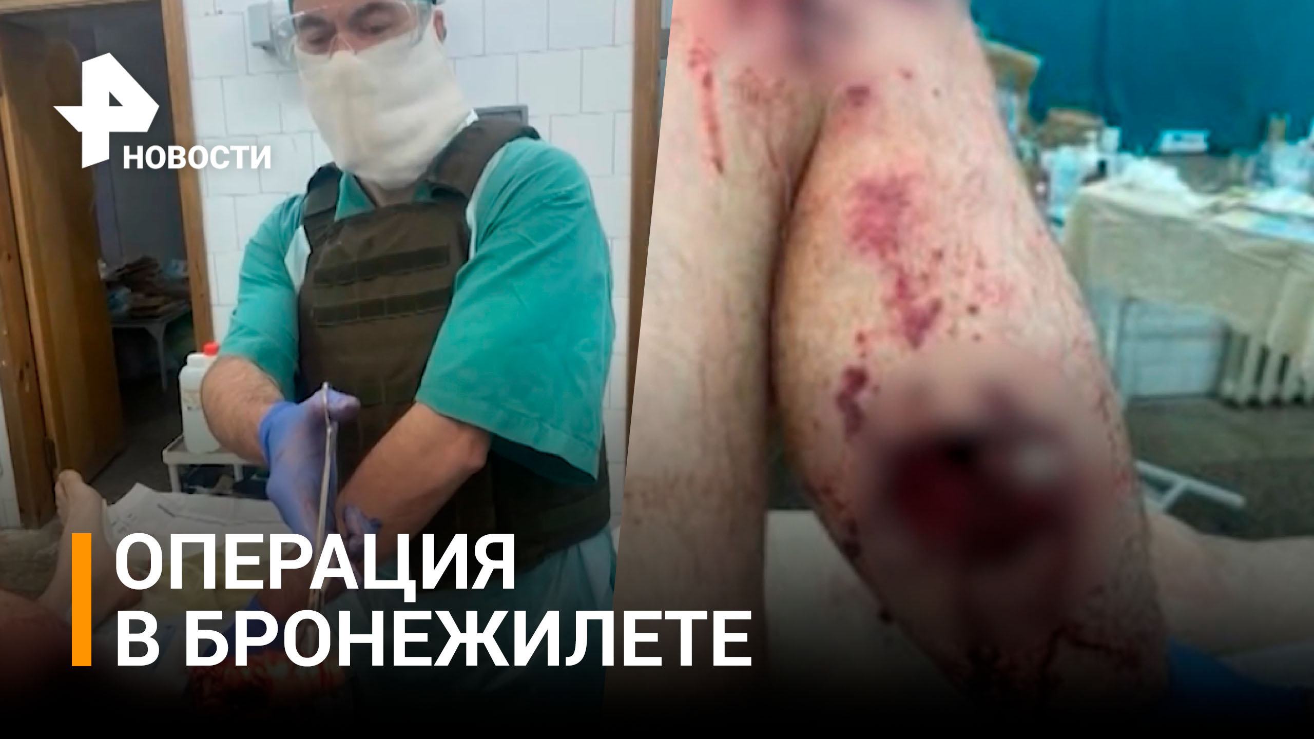 Военные врачи достали взрыватель мины из ноги участника спецоперации / РЕН Новости