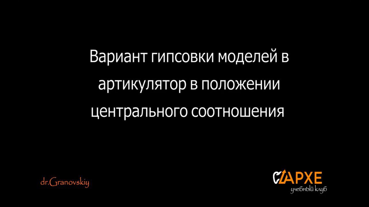 Гипсовка в артикулятор