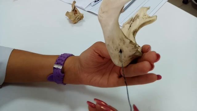 НИЖНЯЯ ЧЕЛЮСТЬ смотреть онлайн