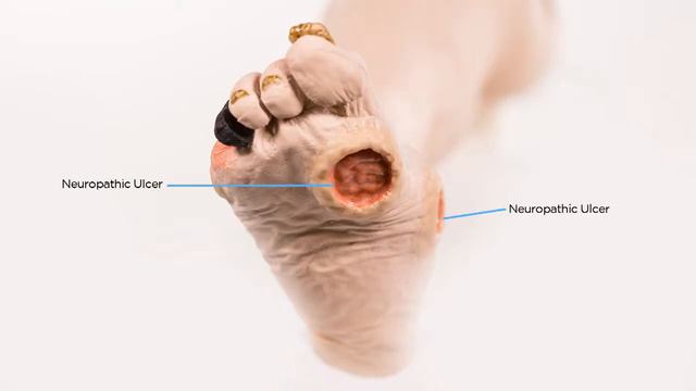 Тренажер артериальной недостаточности ноги смотреть онлайн