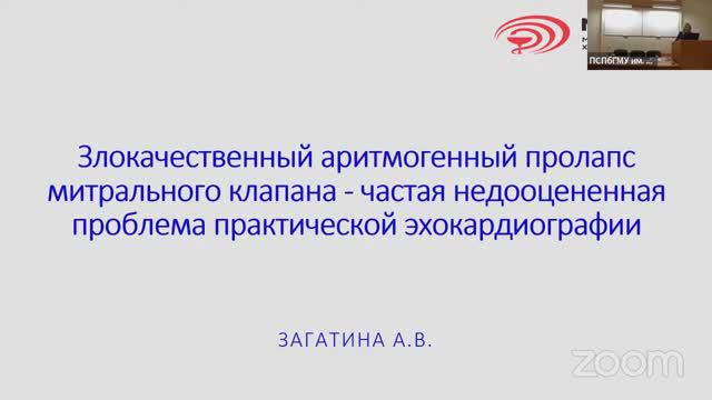 Злокачественный аритмогенный пролапс митрального клапана – частая недооцененная проблема ЭхоКГ