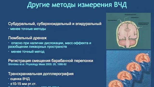 Мониторинг ВЧД