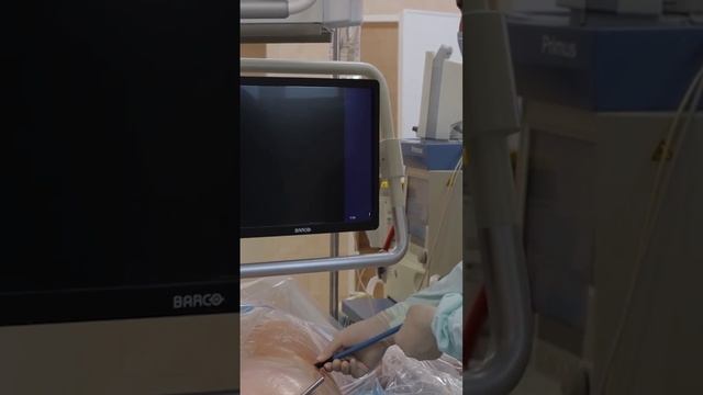 Удаление камня почки через маленькое отверстие в коже смотреть онлайн