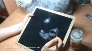 БЕЛЫЙ И ПУШИСТЫЙ (5 ФАКТОВ О ТОПОЛЯХ плюсы пуха)