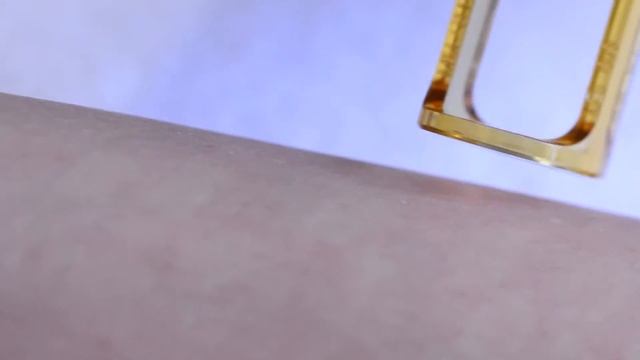 Эпиляция Александритовым лазером Gentle Lase в клинике Telo’s Beauty смотреть онлайн