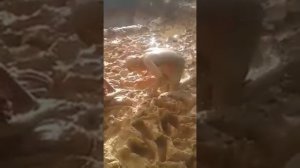 Грязевые ванны.....