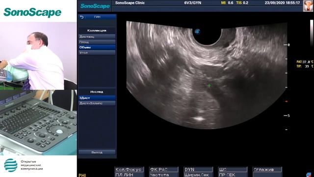 Мастер-класс на аппарате SonoScape S8Exp. Лектор: Буланов М.Н. смотреть онлайн