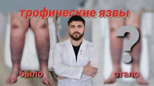 Клинический случай: пациент с трофическими язвами №2