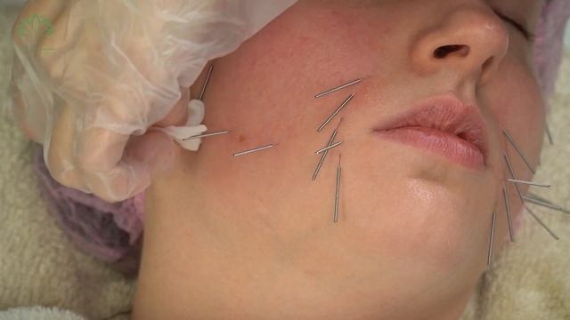 Подтяжка овала. Урок авторского курса Ольги Евдокимовой "Акупунктурный лифтинг лица"