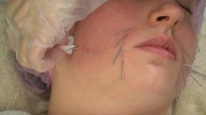 Подтяжка овала. Урок авторского курса Ольги Евдокимовой "Акупунктурный лифтинг лица"
