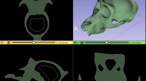 Automatic cavity segmentation tool in 3D Slicer